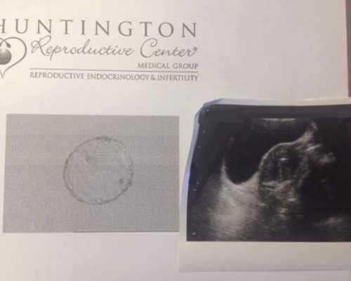 探秘三代试管婴儿费用与省时省钱策略