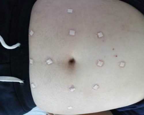 探索辅助生殖技术：重庆地区助孕与试管婴儿指南