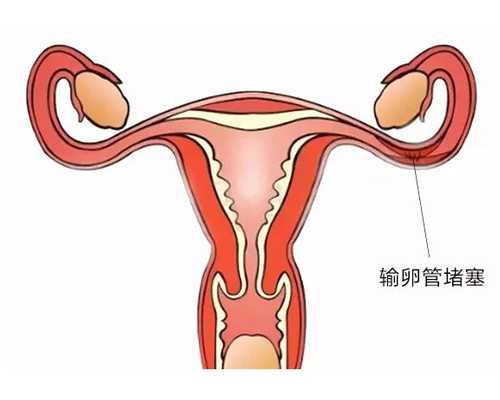重庆代生哪家好 2024重庆不孕不育医院排名，附重庆生殖医院热门推荐 ‘唐筛数
