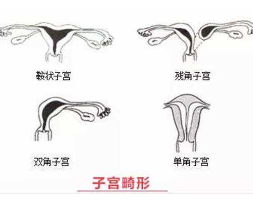 重庆借卵试管代生,重庆市妇幼保健院供精人工授精多少钱 