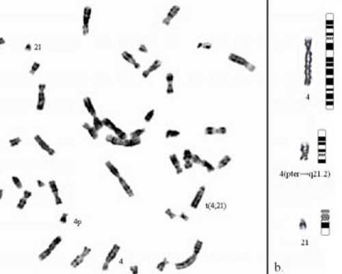 三代试管婴儿技术解析：费用与流程