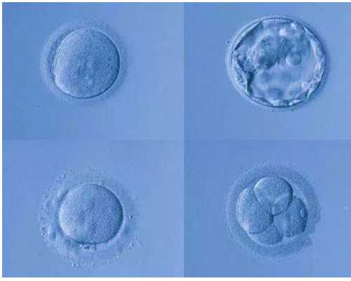 重庆找代怀的论坛 重庆有供卵中心吗? ‘25w彩超看男女’